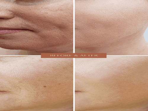 ORGANIC HYALURONIC WRINKLE DEFIER -  For Women and Men - Image 2